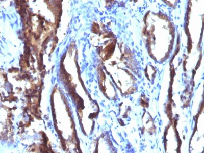 Prostate Specific Antigen / PSA Monoclonal Mouse Antibody (3E6)