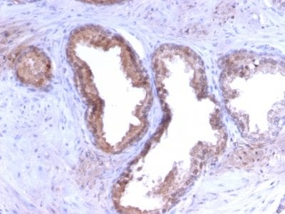 Prostate Specific Antigen / PSA Recombinant Monoclonal Rabbit Antibody (KLK3/2871R)