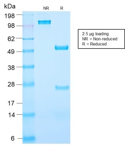 Prostate Specific Antigen / PSA Recombinant Monoclonal Rabbit Antibody (KLK3/2871R)