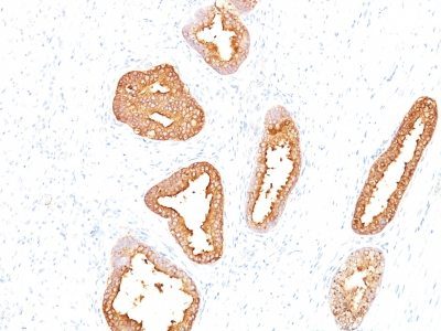 Prostate-Specific Antigen / PSA Monoclonal Mouse Antibody (A67-B/E3)