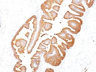 Prostate-Specific Antigen / PSA Monoclonal Mouse Antibody (KLK3/801)