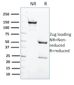Protein Tyrosine Phosphatase, non-receptor type 6 Monoclonal Mouse Antibody (CPTC-PTPN6-2)