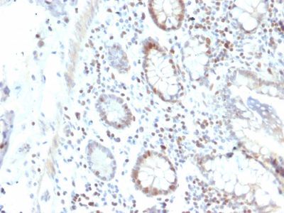 RAD51 Monoclonal Mouse Antibody (RAD51/2702)