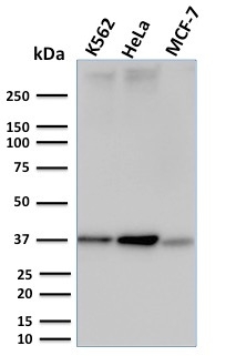 RAD51 Monoclonal Mouse Antibody (RAD51/2753)