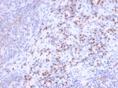RCAS1 / Estrogen Receptor Binding Site Associated, Antigen 9 Monoclonal Mouse Antibody (CPTC-EBAG9-1)