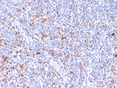 RCAS1 / Estrogen Receptor Binding Site Associated, Antigen 9 Monoclonal Mouse Antibody (CPTC-EBAG9-2)
