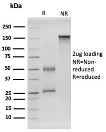 RET Proto-oncogene Monoclonal Mouse Antibody (RET/2599)