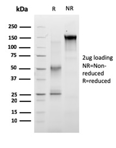 RET Proto-oncogene Monoclonal Mouse Antibody (RET/2663)