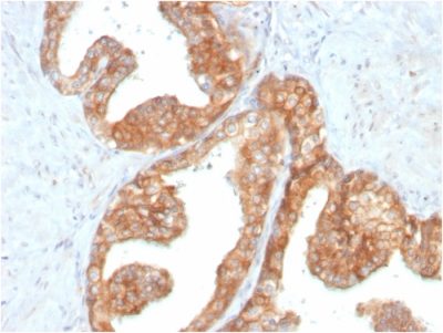 RET Proto-oncogene Monoclonal Mouse Antibody (RET/2795)