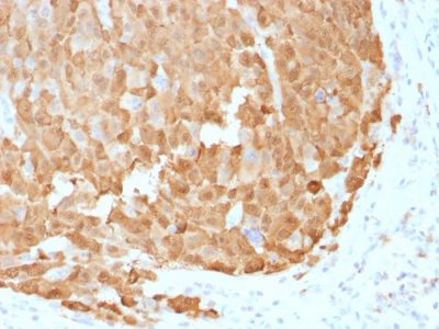 S100A1 Monoclonal Mouse Antibody (S100A1/1942)
