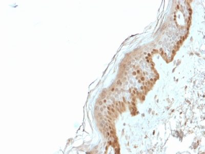 S100A2 / S100 Calcium Binding Protein A2 Monoclonal Mouse Antibody (CPTC-S100A2-2)