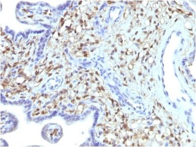 S100A4 Monoclonal Mouse Antibody (S100A4/1481)