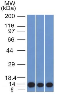 S100A4 Monoclonal Mouse Antibody (S100A4/1481)