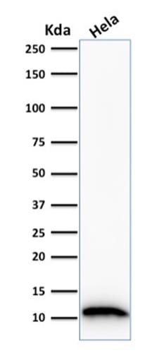 S100A4 Monoclonal Mouse Antibody (S100A4/1481)