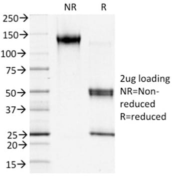 S100A4 Monoclonal Mouse Antibody (S100A4/1481)
