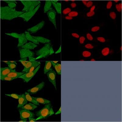 S100A4 Monoclonal Mouse Antibody (S100A4/1481)
