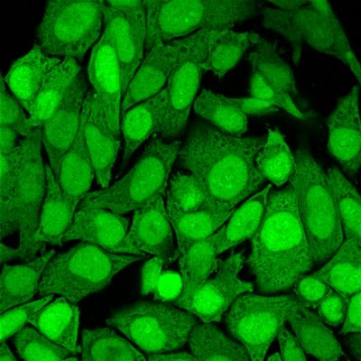 S100A4 Monoclonal Mouse Antibody (S100A4/1482)