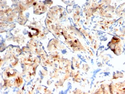 S100A4 Recombinant Monoclonal Mouse Antibody (rS100A4/1481)
