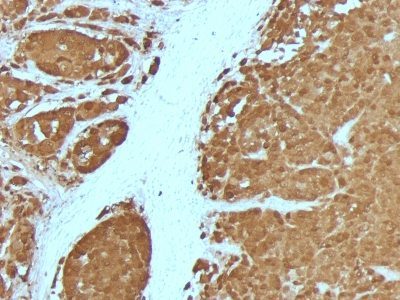 S100B Monoclonal Mouse Antibody (4C4.9 + S100B/1012)