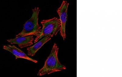 S100B Monoclonal Mouse Antibody (4C4.9 + S100B/1012)