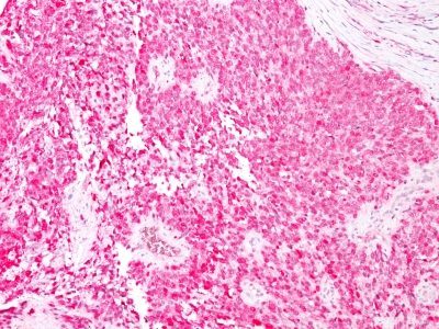 S100B Monoclonal Mouse Antibody (4C4.9)