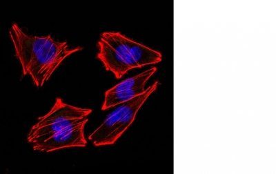 S100B Monoclonal Mouse Antibody (4C4.9)