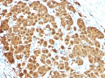 S100B Monoclonal Mouse Antibody (S100B/1012)