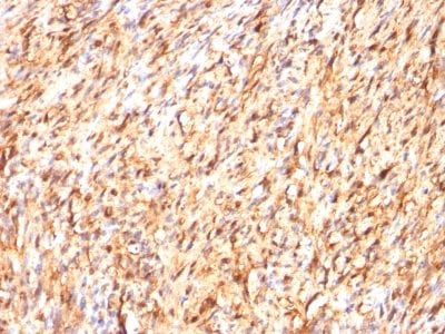 S100B Monoclonal Mouse Antibody (S100B/1012)