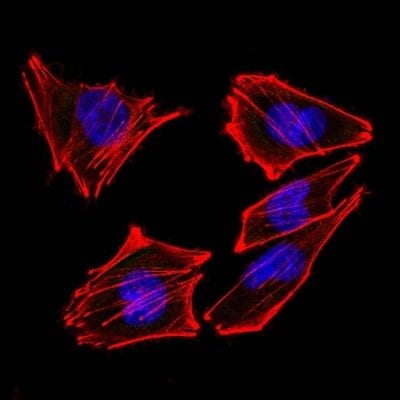 S100B Monoclonal Mouse Antibody (S100B/1012)