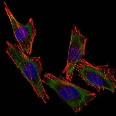 S100B Monoclonal Mouse Antibody (S100B/1012)