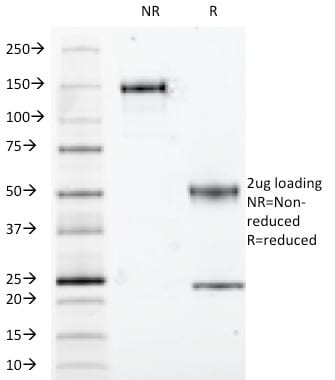 S100B Monoclonal Mouse Antibody (S100B/1012)