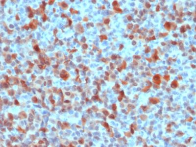 S100B Polyclonal Rabbit Antibody
