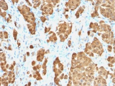 S100B Recombinant Monoclonal Rabbit Antibody (S100B/1706R)