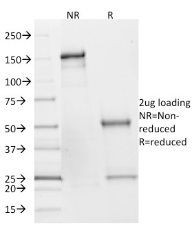 SDHB Monoclonal Mouse Antibody (SDHB/2382)