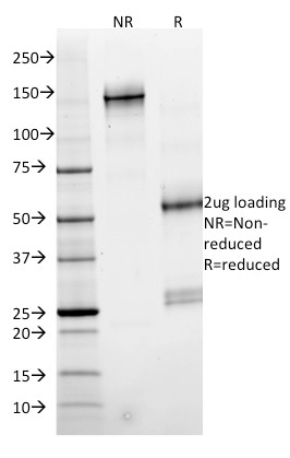SMAD4 Monoclonal Mouse Antibody (SMAD4/2524)