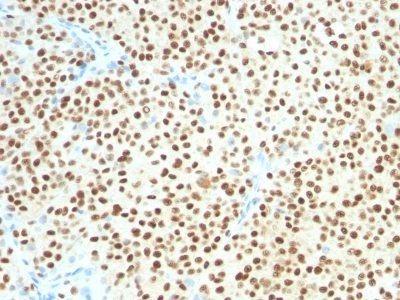 SOX10 Monoclonal Mouse Antibody (SOX10/1074)