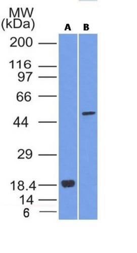 SOX10 Monoclonal Mouse Antibody (SOX10/991 + SOX10/1074)