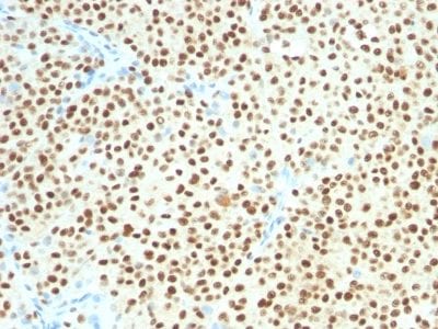 SOX10 Monoclonal Mouse Antibody (SOX10/991 + SOX10/1074)
