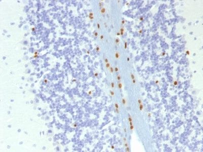 SOX10 Monoclonal Mouse Antibody (SOX10/991 + SOX10/1074)