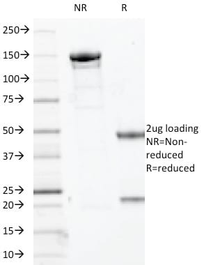 SOX10 Monoclonal Mouse Antibody (SOX10/991 + SOX10/1074)