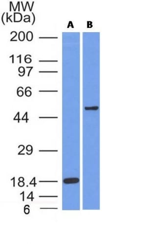 SOX10 Monoclonal Mouse Antibody (SOX10/991)