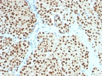 SOX10 Monoclonal Mouse Antibody (SOX10/991)