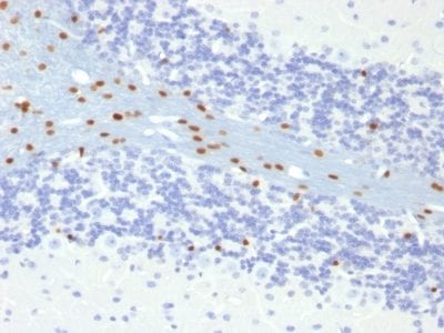 SOX10 Monoclonal Mouse Antibody (SOX10/991)