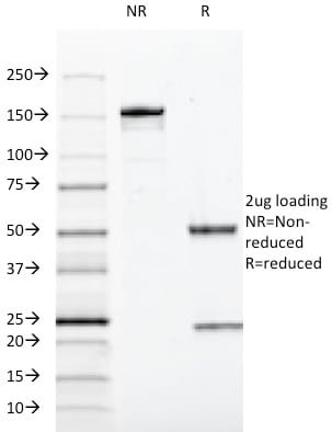 SOX10 Monoclonal Mouse Antibody (SOX10/991)