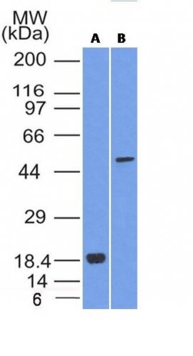 SOX10 Monoclonal Mouse Antibody (SOX10/992)