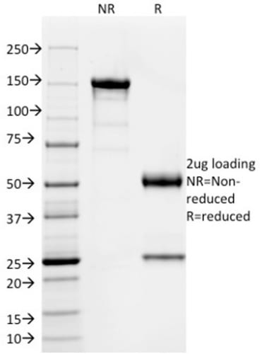 SOX9 / SRY-box 9 Monoclonal Mouse Antibody (PCRP-SOX9-1A2)