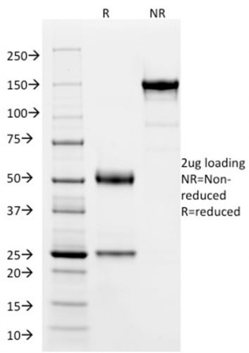 SOX9 / SRY-box 9 Monoclonal Mouse Antibody (PCRP-SOX9-1E5)