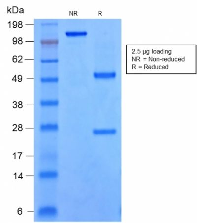 SOX9 / SRY-box 9 Recombinant Monoclonal Mouse Antibody (rSOX9/2288)