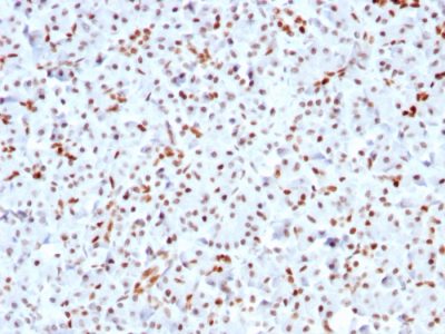 SOX9 / SRY-box 9 Recombinant Monoclonal Rabbit Antibody (SOX9/3141R)
