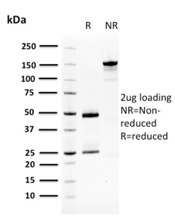 Squamous Cell Carcinoma Antigen 1 Monoclonal Mouse Antibody (CPTC-SERPINB3-2)